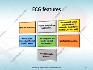 ECG features
PowerPlugs Templates for PowerPoint Preview 4
 