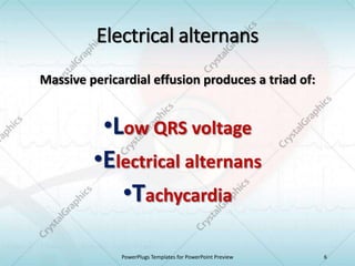 Electrical alternans
Massive pericardial effusion produces a triad of:
•Low QRS voltage
•Electrical alternans
•Tachycardia
PowerPlugs Templates for PowerPoint Preview 6
 