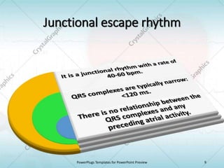 Junctional escape rhythm
PowerPlugs Templates for PowerPoint Preview 9
 