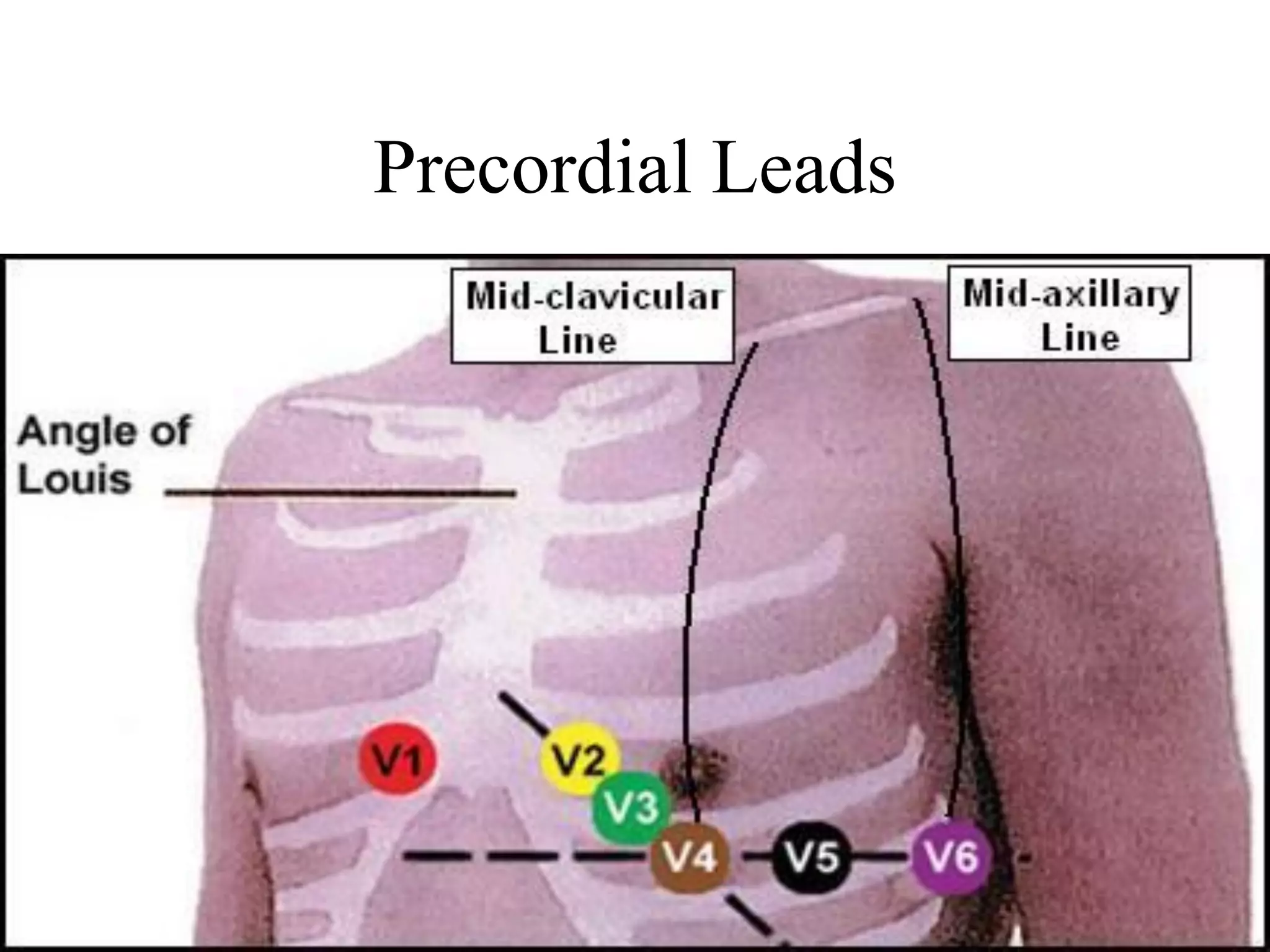 Precordial Leads
 