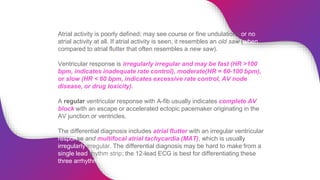 ECG Rhythm Abnormalities | PPTX