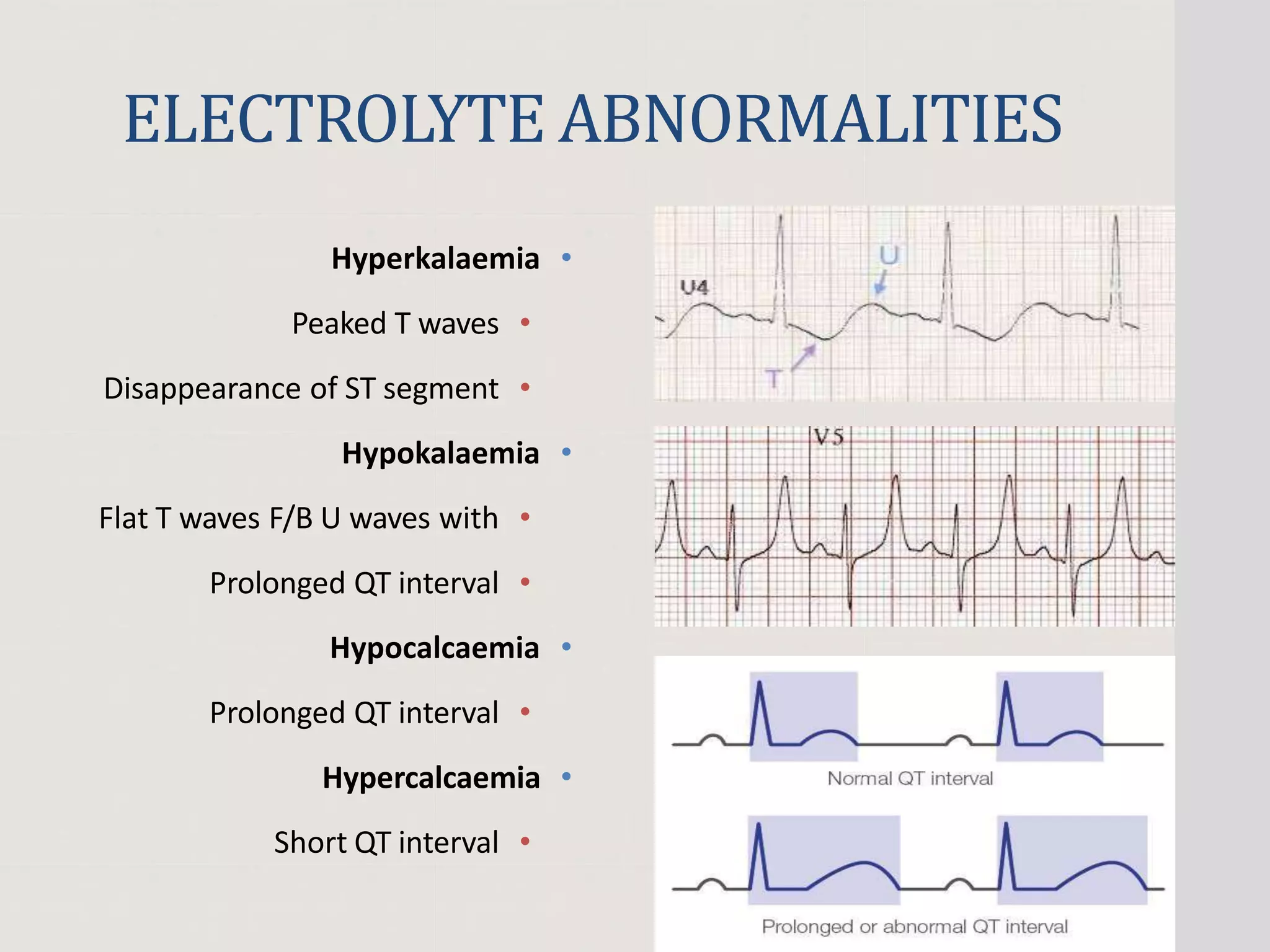 ELECTROLYTE ABNORMALITIES
•
Hyperkalaemia
•
Peaked T waves
•
Disappearance of ST segment
•
Hypokalaemia
•
Flat T waves F/B U waves with
•
Prolonged QT interval
•
Hypocalcaemia
•
Prolonged QT interval
•
Hypercalcaemia
•
Short QT interval
 