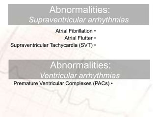 basic ECG SAMPLE WAY | PPTX