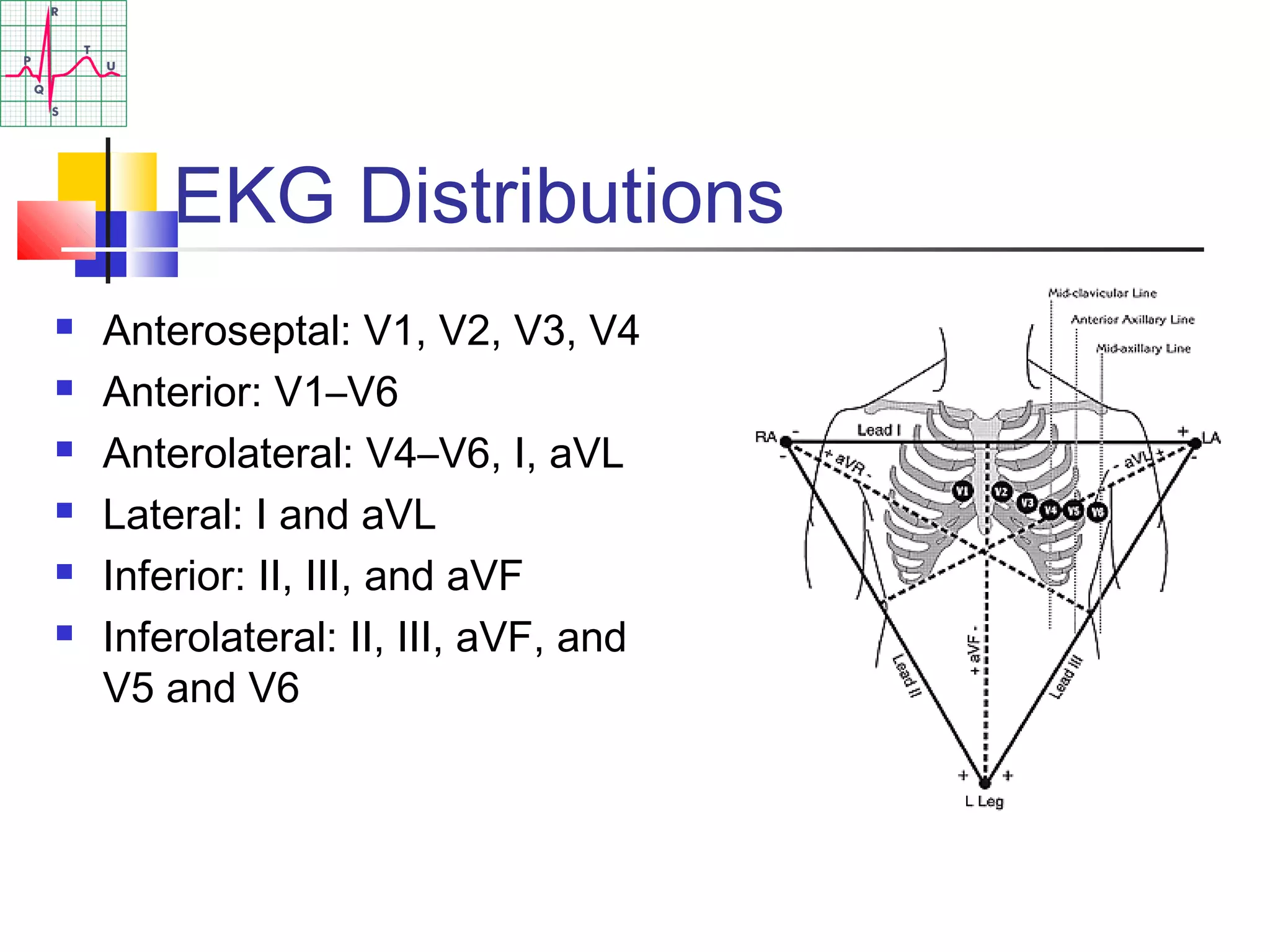 EKG Distributions
 Anteroseptal: V1, V2, V3, V4
 Anterior: V1–V6
 Anterolateral: V4–V6, I, aVL
 Lateral: I and aVL
 Inferior: II, III, and aVF
 Inferolateral: II, III, aVF, and
V5 and V6
 