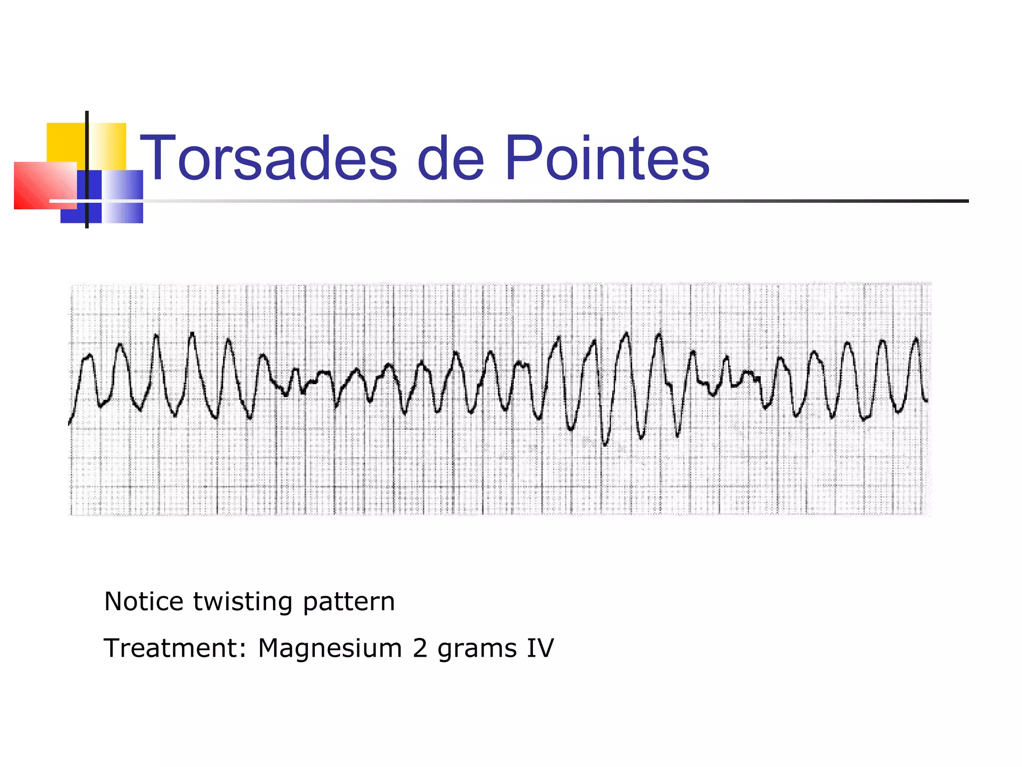 Torsades de Pointes
Notice twisting pattern
Treatment: Magnesium 2 grams IV
 