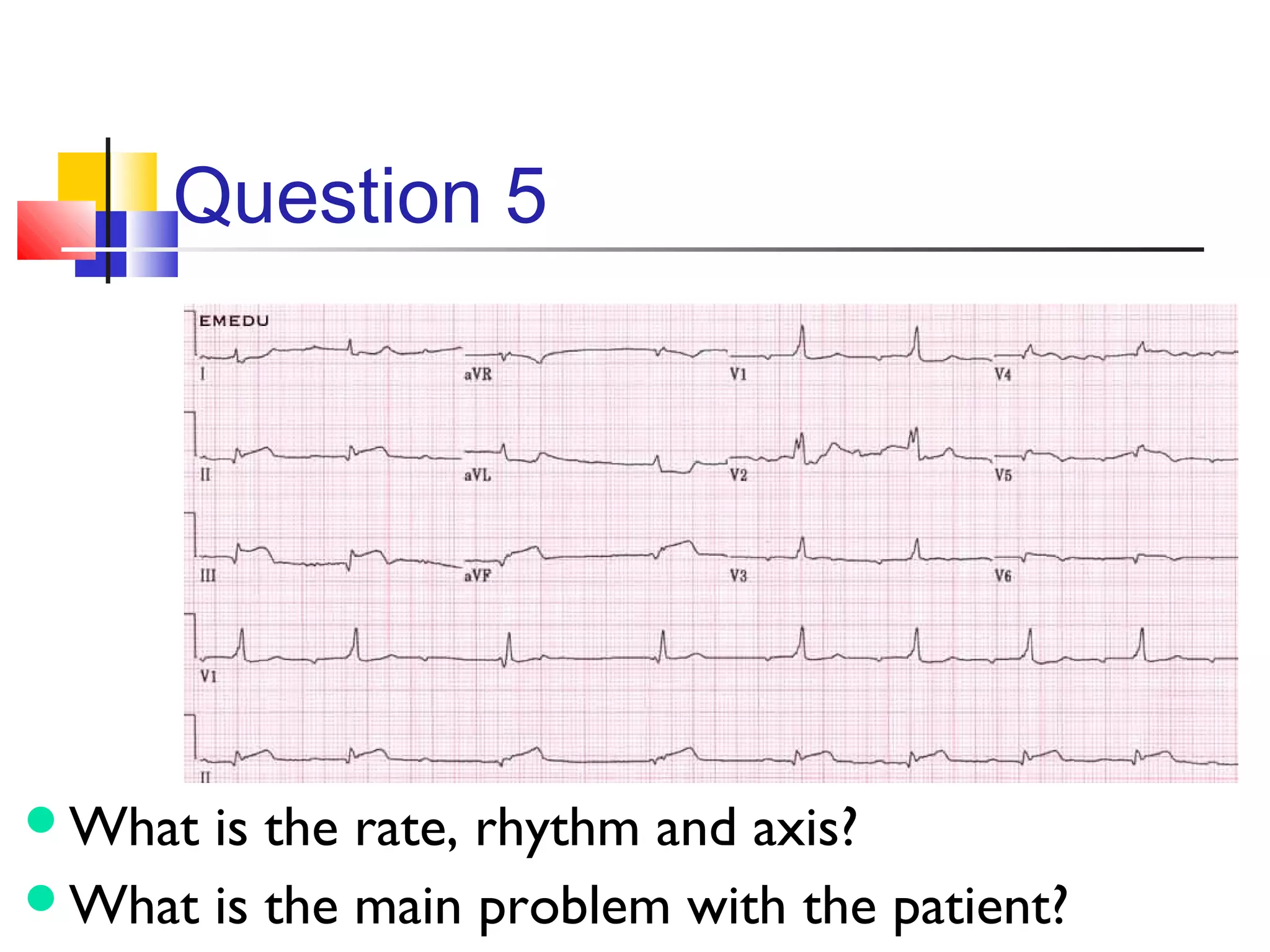 Question 5
What is the rate, rhythm and axis?
What is the main problem with the patient?
 