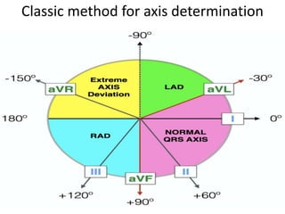 ECG [electrocardiogram].pptx