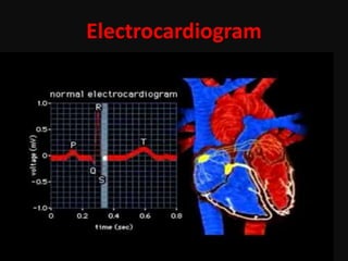Electrocardiogram
 