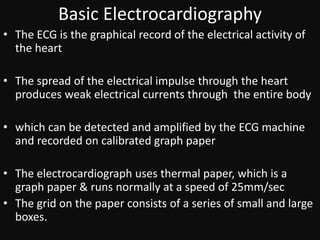 ECG [electrocardiogram].pptx