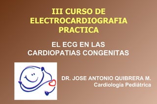 III CURSO DE ELECTROCARDIOGRAFIA PRACTICA EL ECG EN LAS CARDIOPATIAS CONGENITAS DR. JOSE ANTONIO QUIBRERA M. Cardiología Pediátrica 