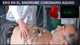 EKG EN EL SINDROME CORONARIO AGUDO
 