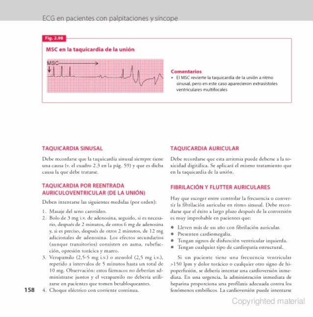 Ecg En La Practica Pdf Ecg en la practica