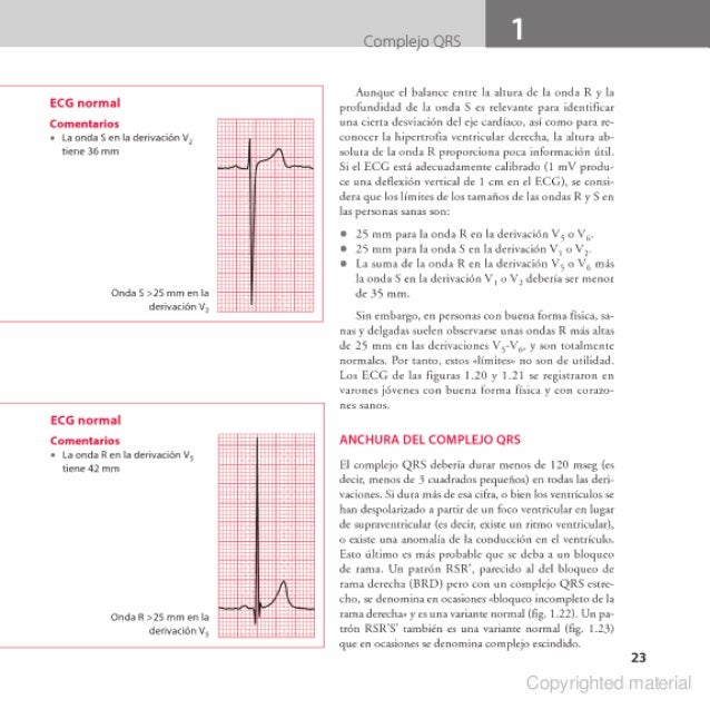 Ecg En La Practica Pdf Ecg en la practica