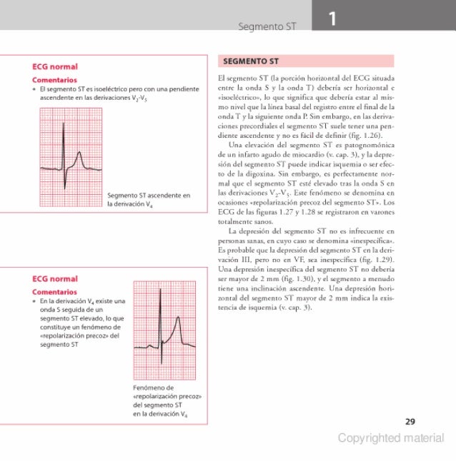 Ecg En La Practica Pdf Ecg en la practica