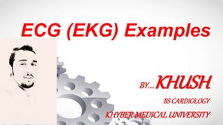 ECG (EKG) Examples
BY....KHUSH
BSCARDIOLOGY
KHYBERMEDICALUNIVERSITY
 