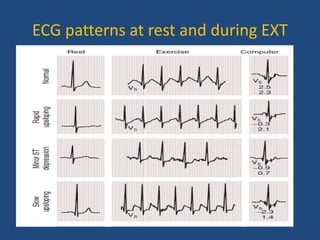 ECG patterns at rest and during EXT
 