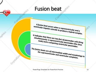 Fusion beat
PowerPlugs Templates for PowerPoint Preview 12
 