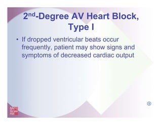 2nd-Degree AV Heart Block,
Type I
• If dropped ventricular beats occur
frequently, patient may show signs and
symptoms of decreased cardiac output
I
 