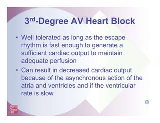 3rd-Degree AV Heart Block
• Well tolerated as long as the escape
rhythm is fast enough to generate a
sufficient cardiac output to maintain
adequate perfusion
• Can result in decreased cardiac output
because of the asynchronous action of the
atria and ventricles and if the ventricular
rate is slow
I
 
