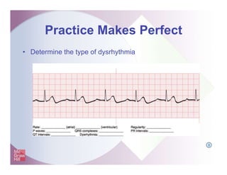 Practice Makes Perfect
• Determine the type of dysrhythmia
I
 