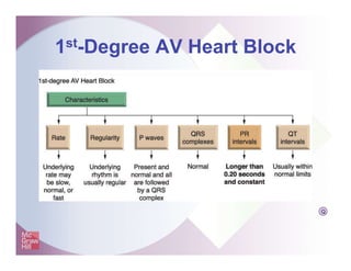 1st-Degree AV Heart Block
Q
 