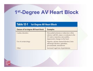 1st-Degree AV Heart Block
 