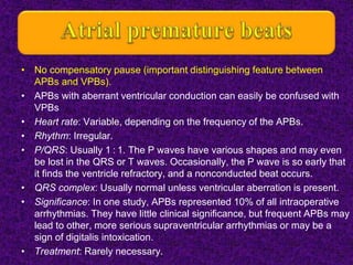 ECG, rapid review of essential topics | PPTX