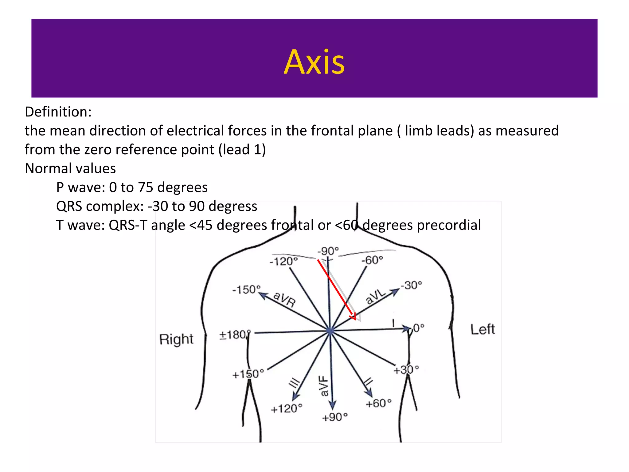 Axis
Definition:
the mean direction of electrical forces in the frontal plane ( limb leads) as measured
from the zero reference point (lead 1)
Normal values
P wave: 0 to 75 degrees
QRS complex: -30 to 90 degress
T wave: QRS-T angle <45 degrees frontal or <60 degrees precordial
 