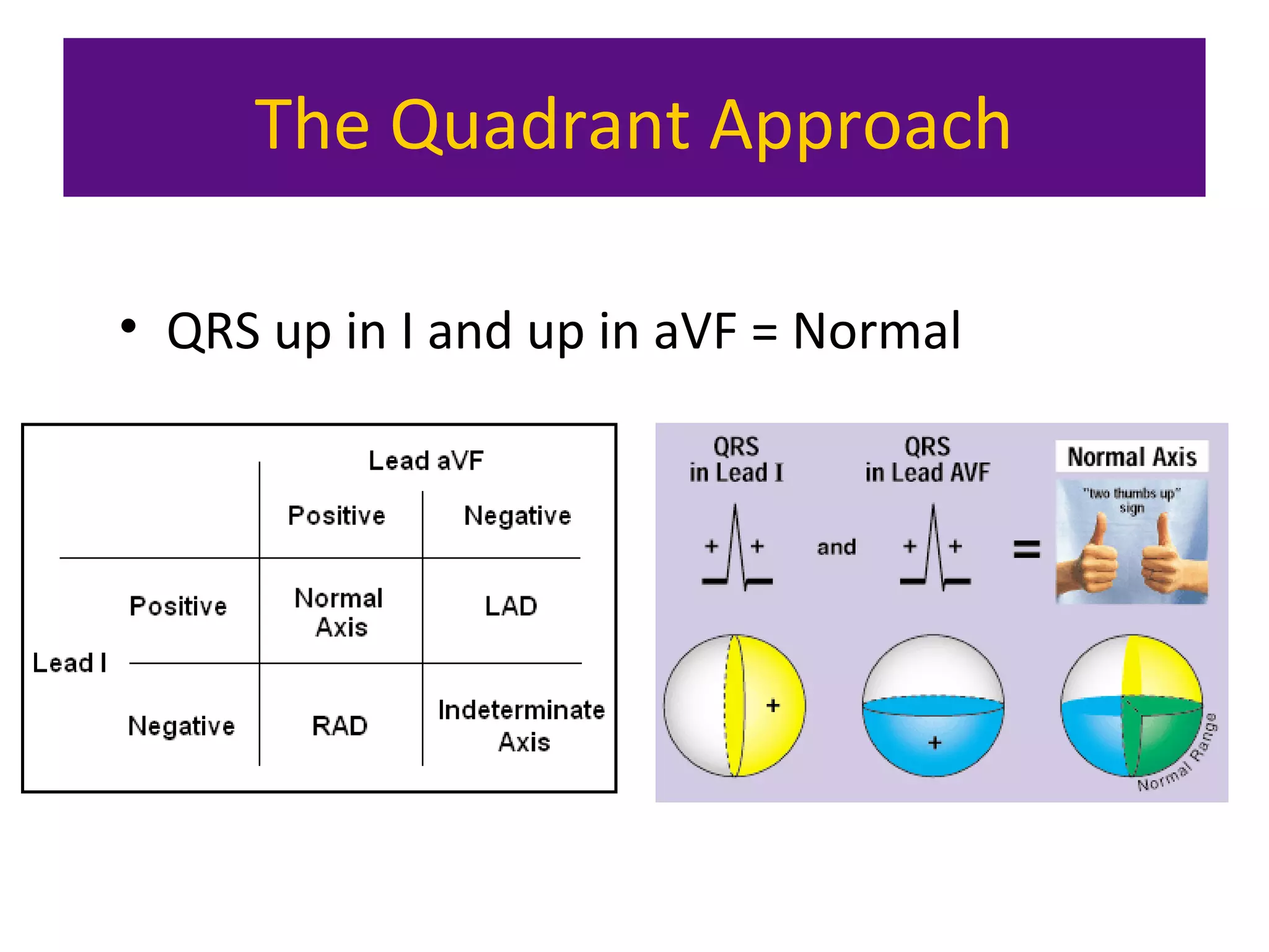 The Quadrant Approach
• QRS up in I and up in aVF = Normal
 