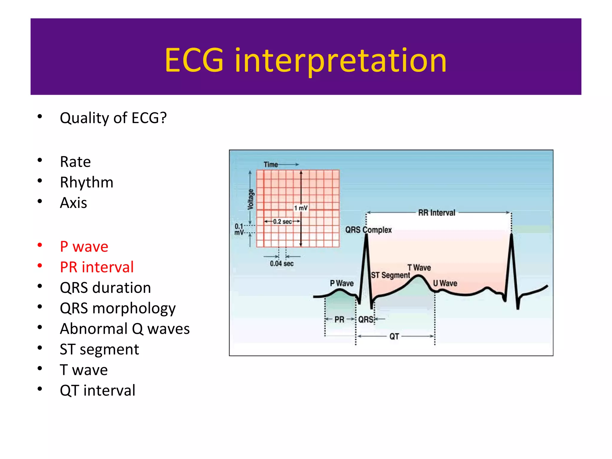 ECG interpretation
• Quality of ECG?
• Rate
• Rhythm
• Axis
• P wave
• PR interval
• QRS duration
• QRS morphology
• Abnormal Q waves
• ST segment
• T wave
• QT interval
 