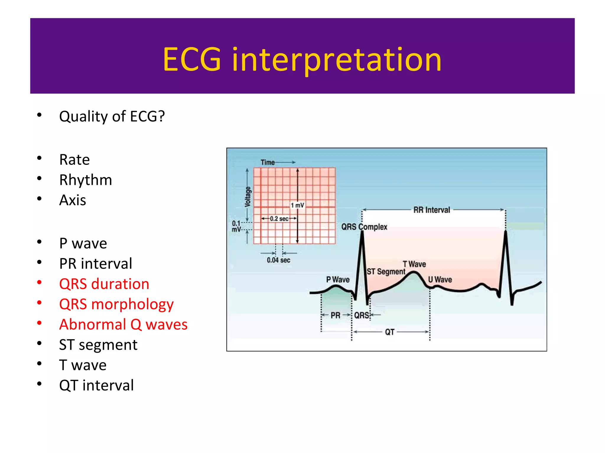 ECG interpretation
• Quality of ECG?
• Rate
• Rhythm
• Axis
• P wave
• PR interval
• QRS duration
• QRS morphology
• Abnormal Q waves
• ST segment
• T wave
• QT interval
 