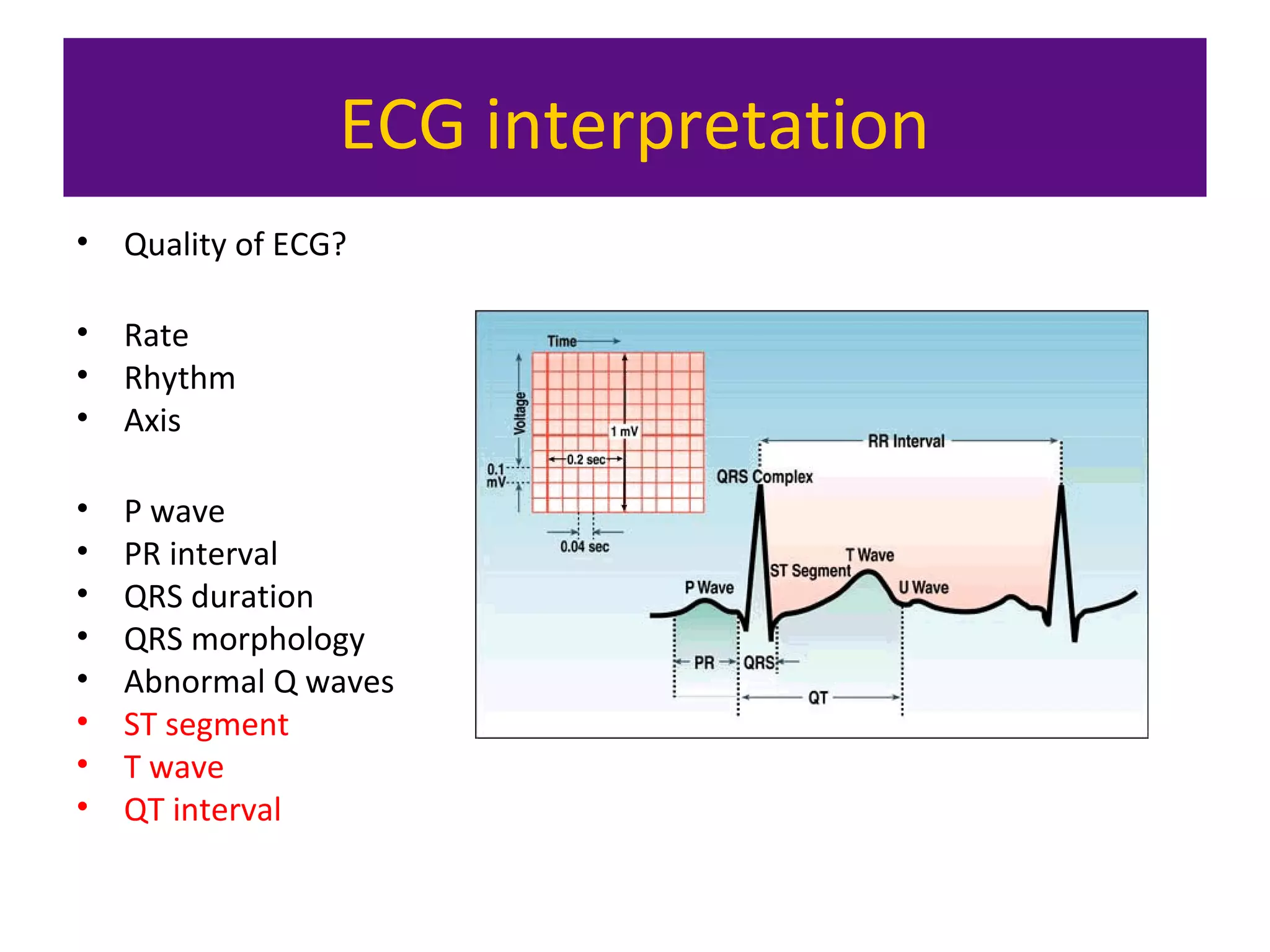 ECG interpretation
• Quality of ECG?
• Rate
• Rhythm
• Axis
• P wave
• PR interval
• QRS duration
• QRS morphology
• Abnormal Q waves
• ST segment
• T wave
• QT interval
 
