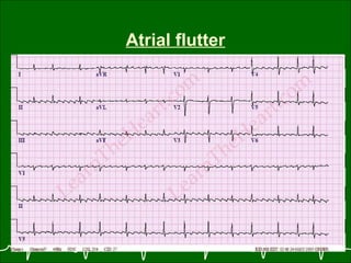 ECG Final Proff.Sumit Kr Ghosh Dept of Internal Medicine Medical ...