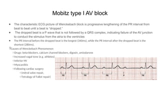 ECG FINAL n akakakakkkakaoppakak(3).pptx