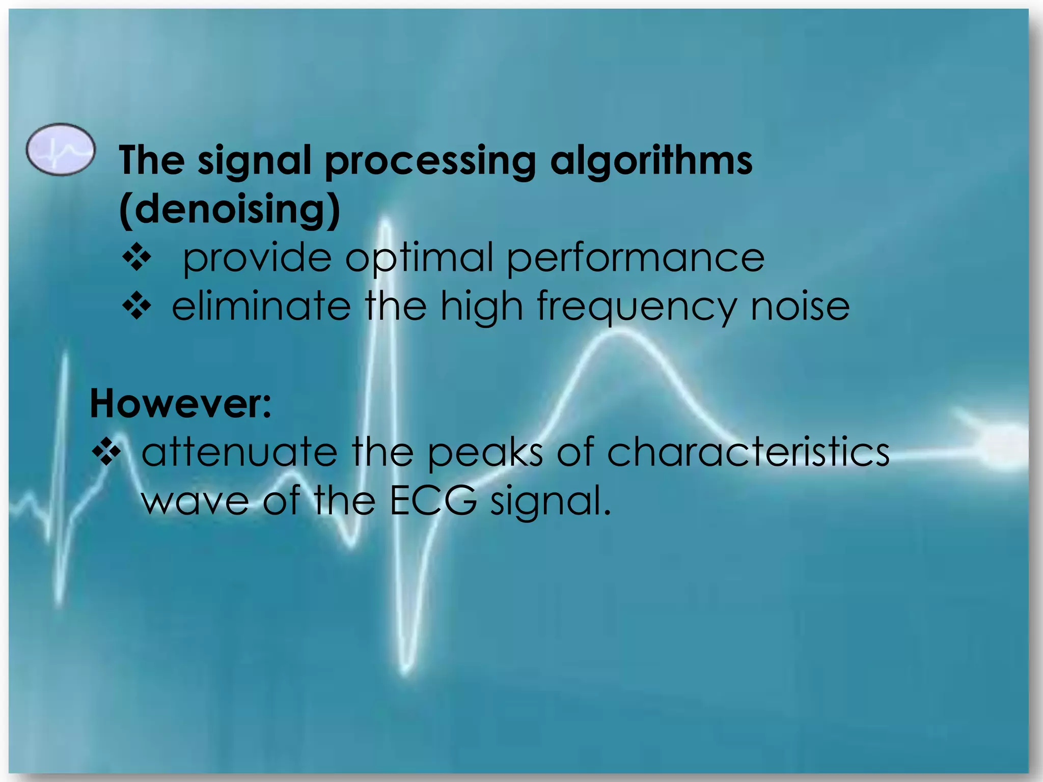 Ecg Signal Processing | PPTX