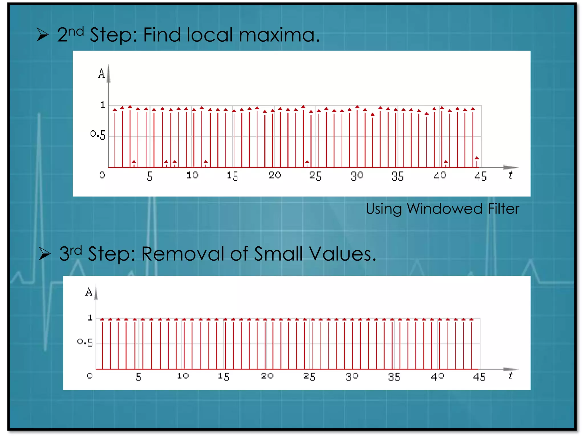 Ecg Signal Processing | PPTX
