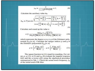 Ecg Signal Processing | PPTX