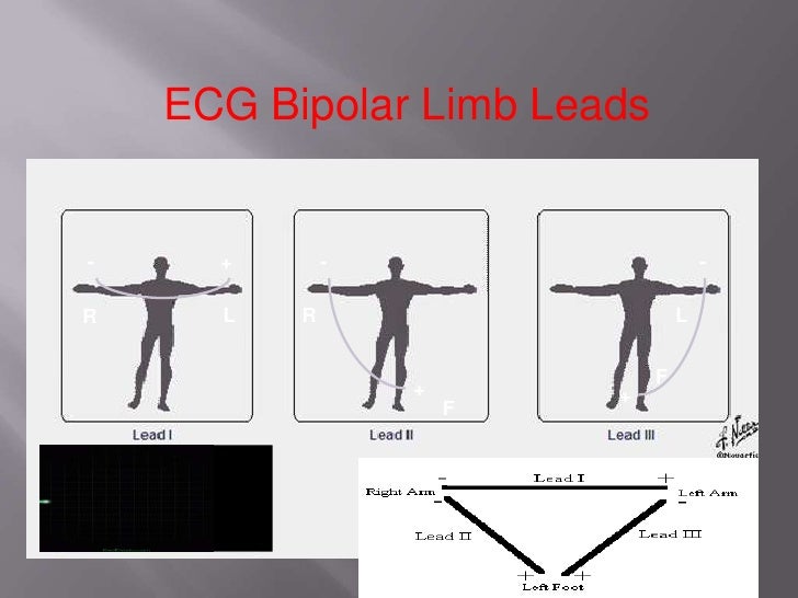 Ecg final pp ts; 19 062012