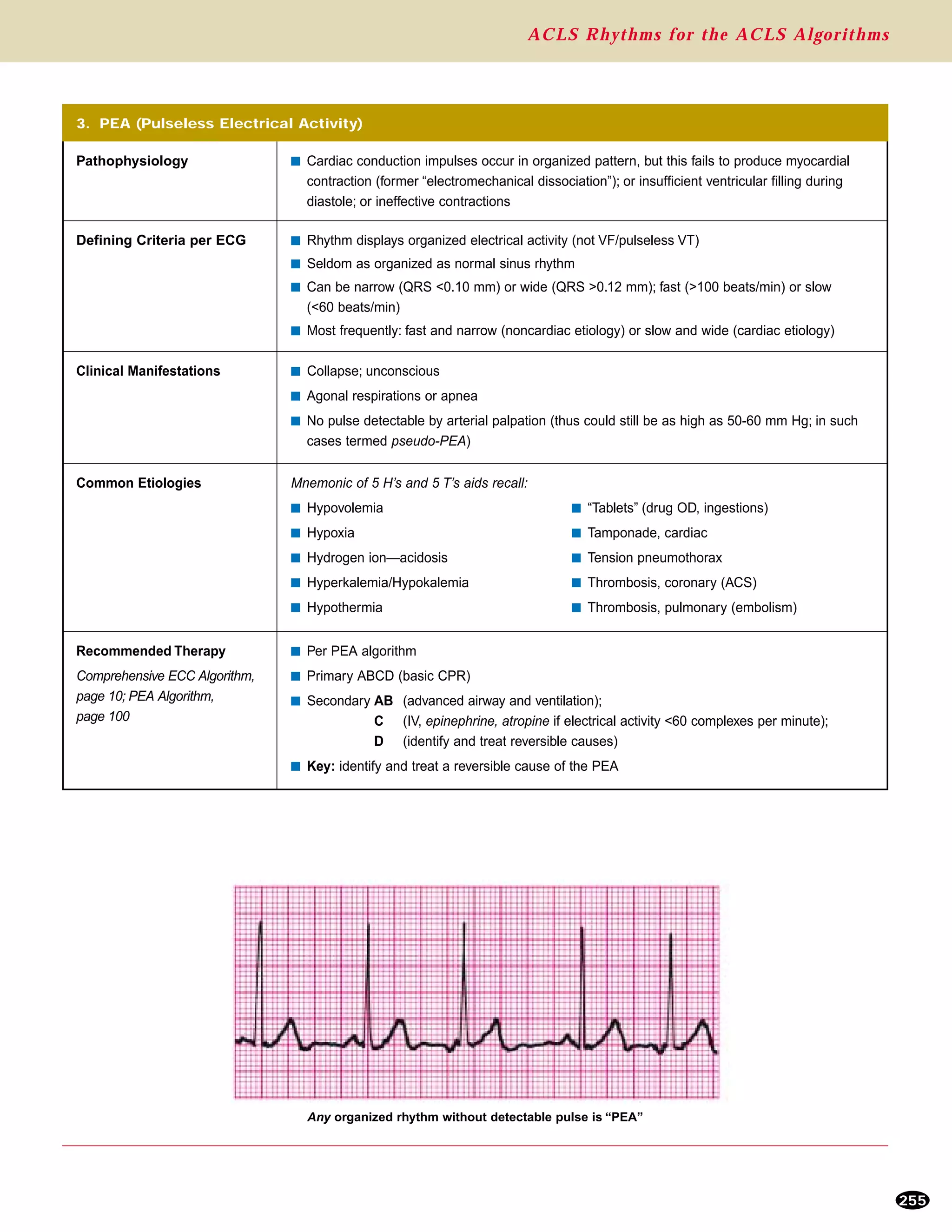 Acls Rhythms Pg 4 Of 7 Cardiovascularcartoon Acls Ekg