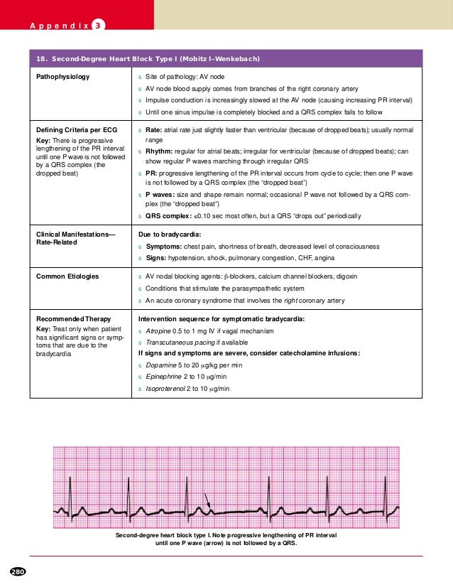 Ecg For Acls