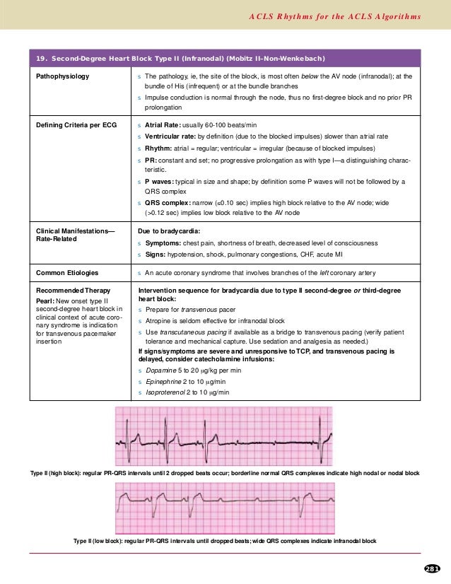 Ecg for acls