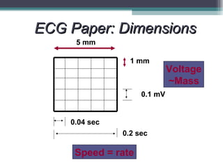 Ecg For Beginners