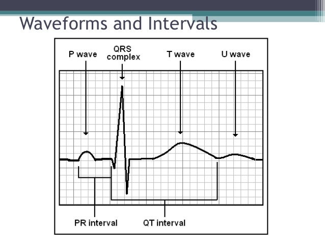 Ecg For Beginners