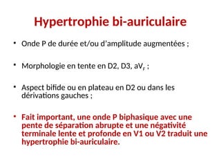 Hypertrophie bi-auriculaire
• Onde P de durée et/ou d’amplitude augmentées ;
• Morphologie en tente en D2, D3, aVF ;
• Aspect bifide ou en plateau en D2 ou dans les
dérivations gauches ;
• Fait important, une onde P biphasique avec une
pente de séparation abrupte et une négativité
terminale lente et profonde en V1 ou V2 traduit une
hypertrophie bi-auriculaire.
 