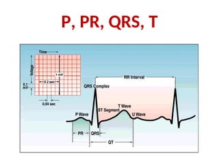 P, PR, QRS, T
 