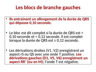 Les blocs de branche gauches
• Ils entrainent un allongement de la durée de QRS
qui dépasse 0,10 seconde.
• Le bloc est dit complet si la durée de QRS est >
0,10 seconde et < 0,12 seconde. Il est complet
lorsque la durée de QRS est ≥ 0,12 seconde.
• Les dérivations droites (V1, V2) enregistrent un
aspect rS ou QS avec une onde T positive. Les
dérivations gauches (D1, V5, V6) enregistrent un
aspect RR’ (ou en M); l’onde T est négative.
 