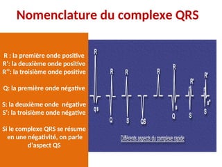 Nomenclature du complexe QRS
R : la première onde positive
R’: la deuxième onde positive
R’’: la troisième onde positive
Q: la première onde négative
S: la deuxième onde négative
S’: la troisième onde négative
Si le complexe QRS se résume
en une négativité, on parle
d’aspect QS
 