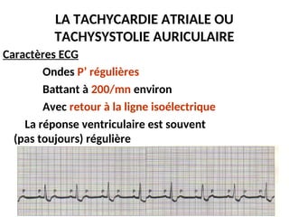 LA TACHYCARDIE ATRIALE OU
TACHYSYSTOLIE AURICULAIRE
Caractères ECG
Ondes P’ régulières
Battant à 200/mn environ
Avec retour à la ligne isoélectrique
La réponse ventriculaire est souvent
(pas toujours) régulière
 