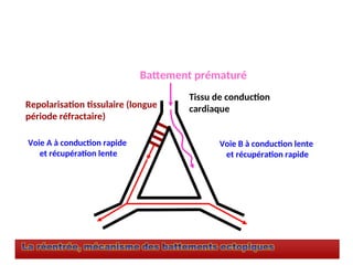 Voie A à conduction rapide
et récupération lente
Voie B à conduction lente
et récupération rapide
Battement prématuré
Tissu de conduction
cardiaque
Repolarisation tissulaire (longue
période réfractaire)
 