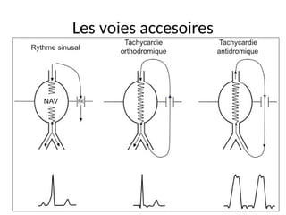 Les voies accesoires
 